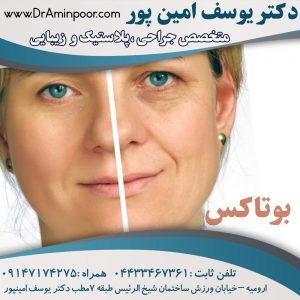 تزریق بوتاکس ارومیه
